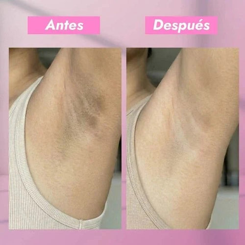 ONIX SKINCARE - Antitranspirante Aclarante