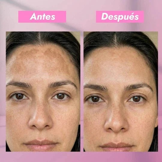 ONIX SKINCARE - Despigmentante Loción Facial